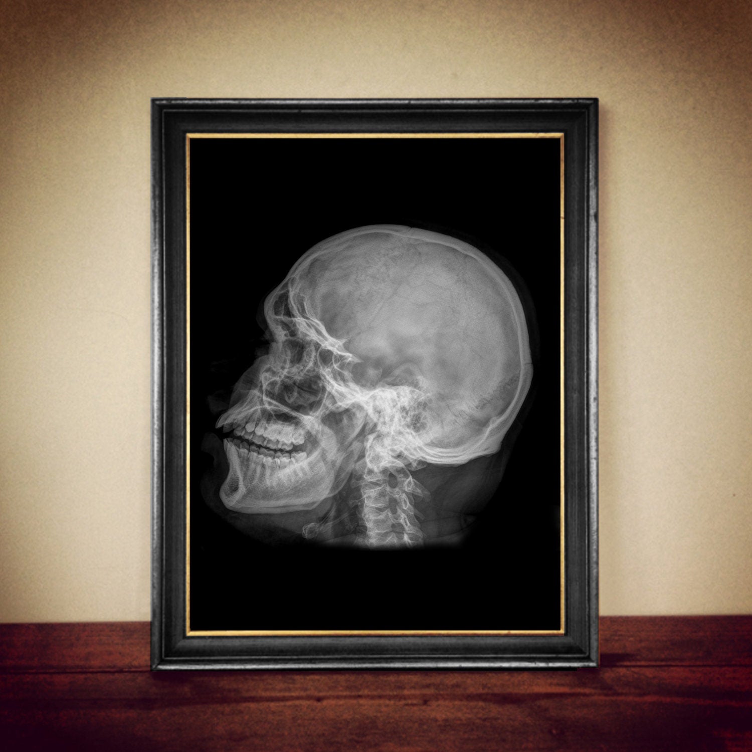 X-ray of the skull print on canvas or antique paper, medical print, skull poster, halloween decor, skull art, bizarre home decor #SB1